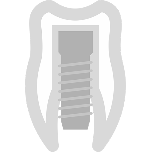 Implantologia Conservativa